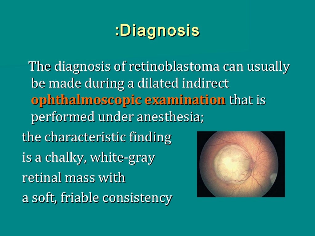 Retinoblastoma, brief overview, June 2013