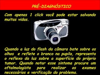 PRÉ-DIAGNÓSTICO
Com apenas 1 click você pode estar salvando
muitas vidas.
Quando a luz do flash da câmara bate sobre os
olhos e reflete o branco na pupila, representa
o reflexo da luz sobre a superfície do próprio
tumor. Quando notar esse sintoma procure um
oftalmologista para realizar os exames
necessários e verificação do problema.
 