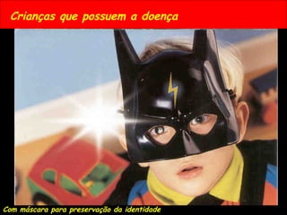 Crianças que possuem a doença
Com máscara para preservação da identidade
 