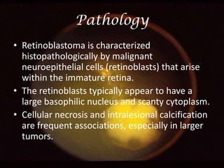Pathology
• Retinoblastoma is characterized
histopathologically by malignant
neuroepithelial cells (retinoblasts) that arise
within the immature retina.
• The retinoblasts typically appear to have a
large basophilic nucleus and scanty cytoplasm.
• Cellular necrosis and intralesional calcification
are frequent associations, especially in larger
tumors.

 