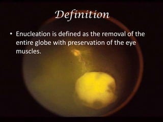 Definition
• Enucleation is defined as the removal of the
entire globe with preservation of the eye
muscles.

 