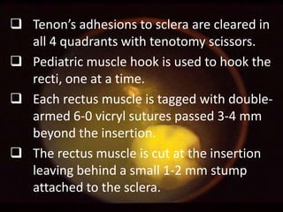  Tenon’s adhesions to sclera are cleared in
all 4 quadrants with tenotomy scissors.
 Pediatric muscle hook is used to hook the
recti, one at a time.
 Each rectus muscle is tagged with doublearmed 6-0 vicryl sutures passed 3-4 mm
beyond the insertion.
 The rectus muscle is cut at the insertion
leaving behind a small 1-2 mm stump
attached to the sclera.

 
