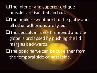 The inferior and superior oblique
muscles are isolated and cut.
The hook is swept next to the globe and
all other adhesions are lysed.
The speculum is next removed and the
globe is prolapsed by pushing the lid
margins backwards.
The optic nerve can be cut either from
the temporal side or nasal side.

 