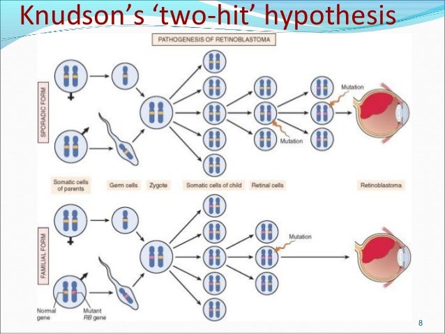 2 hit hypothesis retinoblastoma