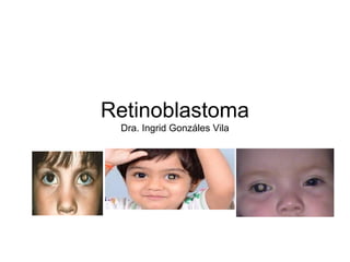 Retinoblastoma
Dra. Ingrid Gonzáles Vila
 