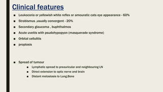 Clinical features
■ Leukocoria or yellowish white reflex or amouratic cats eye appearance - 60%
■ Strabismus ,usually convergent - 20%
■ Secondary glaucoma , buphthalmos
■ Acute uveitis with psudohypopyon (masquerade syndrome)
■ Orbital cellulitis
■ proptosis
■ Spread of tumour
■ Lymphatic spread to preauricular and neighbouring LN
■ Direct extension to optic nerve and brain
■ Distant metastasis to Lung,Bone
 