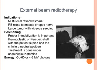 Retinoblastoma | PPTX