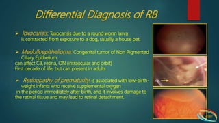 Retinoblastoma | PPTX