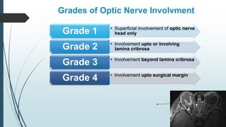 Grades of Optic Nerve Involvment
• Superficial involvement of optic nerve
head only
Grade 1
• Involvement upto or involving
lamina cribrosa
Grade 2
• Involvement beyond lamina cribrosa
Grade 3
• Involvement upto surgical margin
Grade 4
 