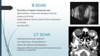 B SCAN
Rounded or irregular intraocular mas
Demonstrates a mass more echogenic than the
vitreous on B mode.
Highly reflective intrinsic echoes of fine calcifications
on A mode.
Accuracy 80%
CT SCAN
Delineates extraocular extension
Can detect Asso. Pinealoblastoma
Cases with atypical manisfestations
Diagnostic dilemma Extraocular &I ntracranial tumour
extension is suspected
 