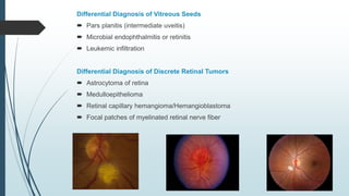 Differential Diagnosis of Vitreous Seeds
 Pars planitis (intermediate uveitis)
 Microbial endophthalmitis or retinitis
 Leukemic infiltration
Differential Diagnosis of Discrete Retinal Tumors
 Astrocytoma of retina
 Medulloepithelioma
 Retinal capillary hemangioma/Hemangioblastoma
 Focal patches of myelinated retinal nerve fiber
 