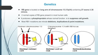 Genetics
 RB gene is located on long arm of chromosome 13 (13q14) containing 27 exons & 26
introns.
 2 normal copies of RB gene present in most human cells
 It produces a phosphoprotein whose normal function is to suppress cell growth.
 Most RB1 mutations are minute deletions, duplications & point mutations.
 