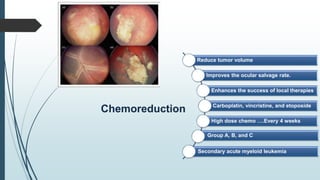 Chemoreduction
Reduce tumor volume
Improves the ocular salvage rate.
Enhances the success of local therapies
Carboplatin, vincristine, and etoposide
High dose chemo ….Every 4 weeks
Group A, B, and C
Secondary acute myeloid leukemia
 