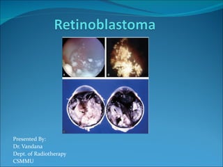 Presented By:
Dr. Vandana
Dept. of Radiotherapy
CSMMU
 