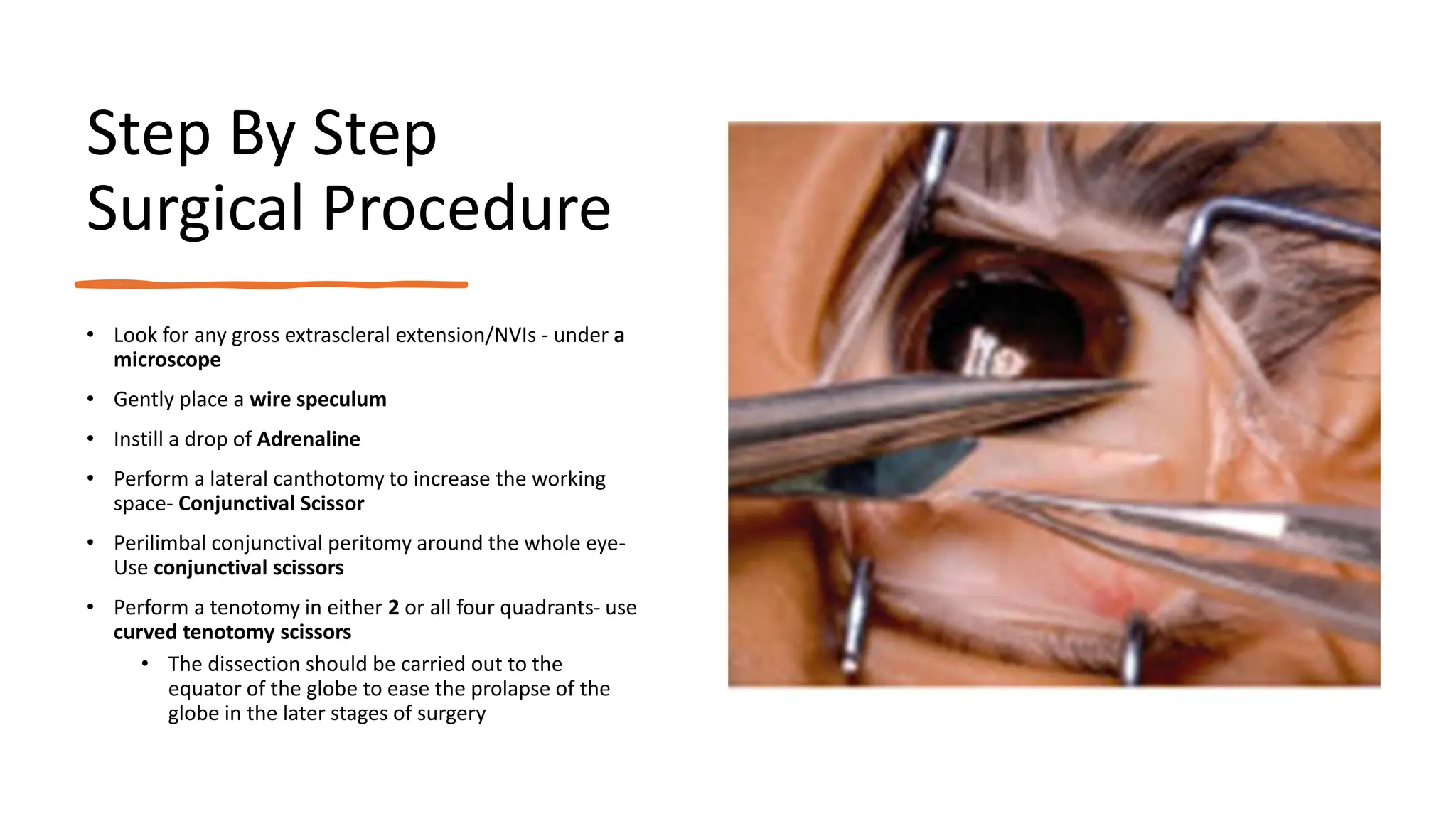 Auto Enucleation Retinoblastoma-ENUCLEATION A STEP BY STEP APPROACH.pptx
