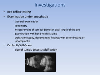 Investigations
• Red reflex testing
• Examination under anesthesia
- General examination
- Tonometry
- Measurement of corneal diameter, axial length of the eye
- Examination with hand-held slit-lamp
- Ophthalmoscopy, documenting findings with color drawing or
photography
• Ocular U/S (B-Scan)
- size of tumor, detects calcification
 