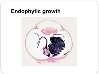 Endophytic growth
 