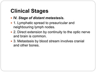 Clinical Stages
 IV. Stage of distant metastasis.
 1. Lymphatic spread to preauricular and
neighbouring lymph nodes.
 2. Direct extension by continuity to the optic nerve
and brain is common.
 3. Metastasis by blood stream involves cranial
and other bones.
 