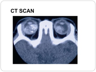 CT SCAN
 