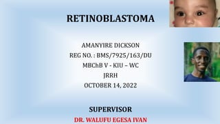 RETINOBLASTOMA
AMANYIRE DICKSON
REG NO. : BMS/7925/163/DU
MBChB V - KIU – WC
JRRH
OCTOBER 14, 2022
SUPERVISOR
DR. WALUFU EGESA IVAN
 