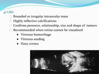 4) USG
⮚ Rounded or irregular intraocular mass
⮚ Highly reflective calcifications
⮚ Confirms presence, relationship, size and shape of tumors
⮚ Recommended when retina cannot be visualized
● Vitreous hemorrhage
● Vitreous seeding
● Hazy cornea
 