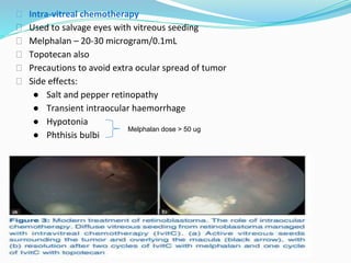 ⮚ Intra-vitreal chemotherapy
⮚ Used to salvage eyes with vitreous seeding
⮚ Melphalan – 20-30 microgram/0.1mL
⮚ Topotecan also
⮚ Precautions to avoid extra ocular spread of tumor
⮚ Side effects:
● Salt and pepper retinopathy
● Transient intraocular haemorrhage
● Hypotonia
● Phthisis bulbi
Melphalan dose > 50 ug
 