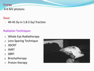 Energy
4-6 MV photons
Dose
⮚ 40-45 Gy in 1.8-2 Gy/ fraction
Radiation Techniques
1. Whole Eye Radiotherapy
2. Lens Sparing Technique
3. 3DCRT
4. IMRT
5. SBRT
6. Brachytherapy
7. Proton therapy
 
