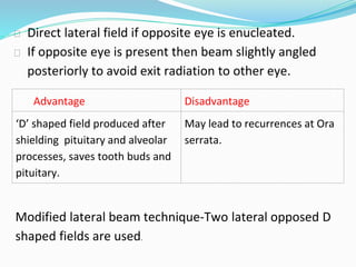 ⮚ Direct lateral field if opposite eye is enucleated.
⮚ If opposite eye is present then beam slightly angled
posteriorly to avoid exit radiation to other eye.
Advantage Disadvantage
‘D’ shaped field produced after
shielding pituitary and alveolar
processes, saves tooth buds and
pituitary.
May lead to recurrences at Ora
serrata.
Modified lateral beam technique-Two lateral opposed D
shaped fields are used.
 
