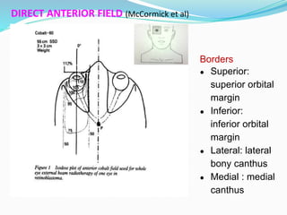 DIRECT ANTERIOR FIELD (McCormick et al)
Borders
● Superior:
superior orbital
margin
● Inferior:
inferior orbital
margin
● Lateral: lateral
bony canthus
● Medial : medial
canthus
 