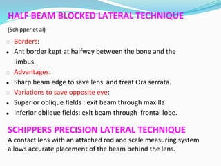 HALF BEAM BLOCKED LATERAL TECHNIQUE
(Schipper et al)
⮚ Borders:
● Ant border kept at halfway between the bone and the
limbus.
⮚ Advantages:
● Sharp beam edge to save lens and treat Ora serrata.
⮚ Variations to save opposite eye:
● Superior oblique fields : exit beam through maxilla
● Inferior oblique fields: exit beam through frontal lobe.
SCHIPPERS PRECISION LATERAL TECHNIQUE
A contact lens with an attached rod and scale measuring system
allows accurate placement of the beam behind the lens.
 