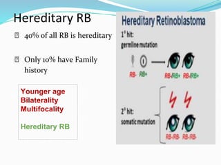 Younger age
Bilaterality
Multifocality
Hereditary RB
Hereditary RB
⮚ 40% of all RB is hereditary
⮚ Only 10% have Family
history
 