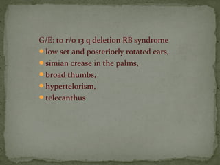 G/E: to r/o 13 q deletion RB syndrome
low set and posteriorly rotated ears,
simian crease in the palms,
broad thumbs,
hypertelorism,
telecanthus
 