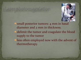 small posterior tumors: 4 mm in basal
diameter and 2 mm in thickness.
delimit the tumor and coagulate the blood
supply to the tumor
less often employed now with the advent of
thermotherapy.
 