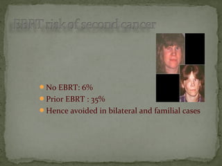 No EBRT: 6%
Prior EBRT : 35%
Hence avoided in bilateral and familial cases
 