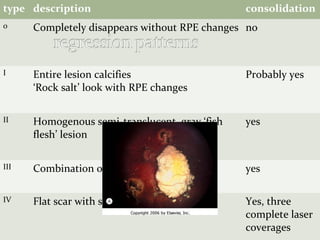 type description consolidation
0 Completely disappears without RPE changes no
I Entire lesion calcifies
‘Rock salt’ look with RPE changes
Probably yes
II Homogenous semi-translucent, gray ‘fish
flesh’ lesion
yes
III Combination of I and II, most common yes
IV Flat scar with significant RPE changes Yes, three
complete laser
coverages
 