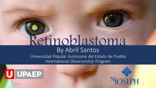 By Abril Santos
Universidad Popular Autónoma del Estado de Puebla
International Observership Program
Retinoblastoma
6/12/2015 1
 