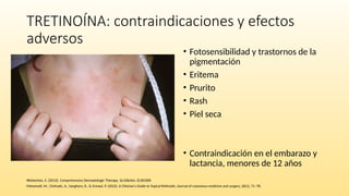Retinoid Rash Retinoides tópicos y sistémicos en dermatologia | PPTX