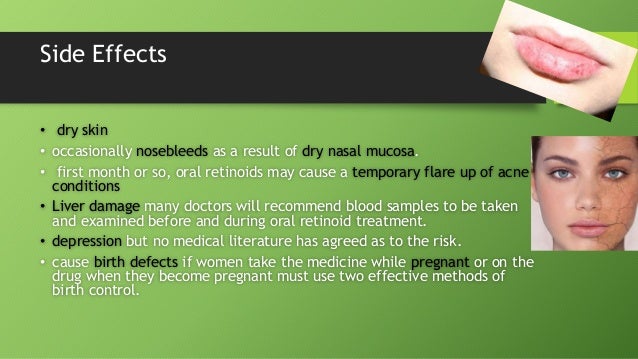 liposuction side effects liposuction side effects