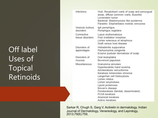 Off label
Uses of
Topical
Retinoids
Sarkar R, Chugh S, Garg V. Acitretin in dermatology. Indian
Journal of Dermatology, Venereology, and Leprology.
2013;79(6):759.
 