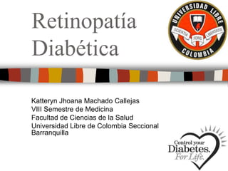 Retinopatía
Diabética
Katteryn Jhoana Machado Callejas
VIII Semestre de Medicina
Facultad de Ciencias de la Salud
Universidad Libre de Colombia Seccional
Barranquilla
 