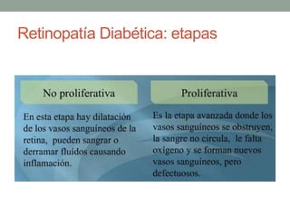 Retinopatía Diabética: etapas
 