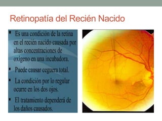 Retinopatía del Recién Nacido
 
