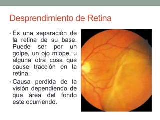 Desprendimiento de Retina
• Es una separación de
  la retina de su base.
  Puede ser por un
  golpe, un ojo miope, u
  alguna otra cosa que
  cause tracción en la
  retina.
• Causa perdida de la
  visión dependiendo de
  que área del fondo
  este ocurriendo.
 