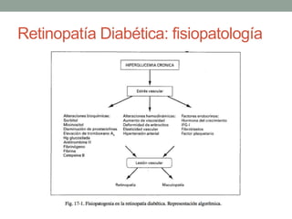 Retinopatía Diabética: fisiopatología
 