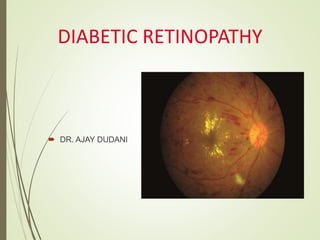 DIABETIC RETINOPATHY
 DR. AJAY DUDANI
 