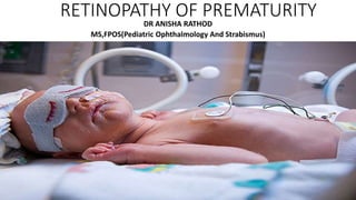 RETINOPATHY OF PREMATURITY
DR ANISHA RATHOD
MS,FPOS(Pediatric Ophthalmology And Strabismus)
 