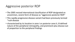 Agressive Rop Retinopathy of prematurity | PPTX