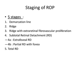 Vascular Ridge Rop Retinopathy of prematurity | PPTX