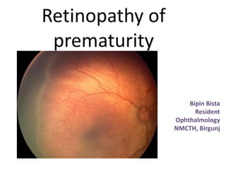 Retinopathy of
prematurity
Bipin Bista
Resident
Ophthalmology
NMCTH, Birgunj
 
