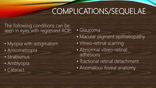 Retinopathy of Prematurity | PPTX